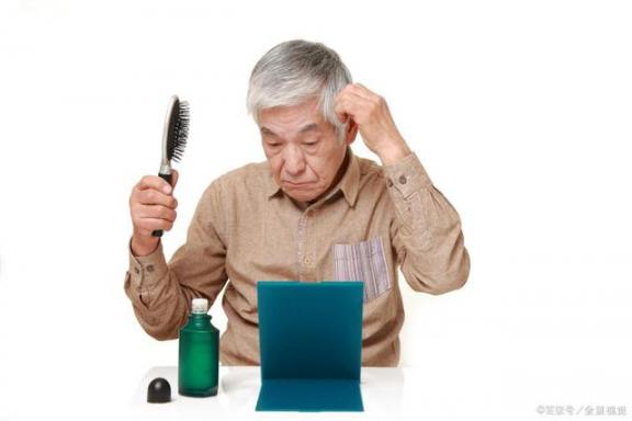 男人容易变“光头”？日常做好这4件事，或能“逃过一劫”  再快点我我想要啊 想要这一种幸福 毛发移植手术 想要幸福的人 怎样做好品牌推广 头发多适合的发型 治疗秃顶的最好方法 光头仔童装 种植毛发那个好 男人为什么喜欢接吻 第2张