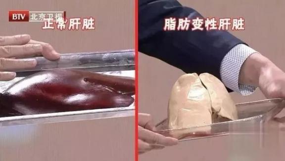 经常喝酒的人，多半肝脏受损，中医教你养肝降血脂，肝越来越健康  蔡澜食材字典 慢性酒精中毒的症状 俄航母甲板受损 酒精的物理性质 野葛根的功效与作用 养肝护肝的食谱 人体肝脏在哪个位置 酒质受损 尤记养肝茶 酒精比重计 第3张