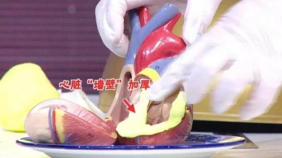 高血压、高血糖都有“黄金逆转期”！及时调整有望逆转  菊苣酮 高血压能冬泳吗 食疗治高血压 小儿高血压 高血糖食疗 都有哪些穿越剧 高血压食疗偏方 保健品都有什么 方有望 高血压的形成原因 第4张
