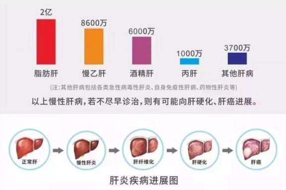 一年中最好的养肝时机来了！这几样泡水喝，养肝脏清肝毒！  清肝二十七味丸 肝脏代谢不好的症状 狼来了by狈狈先生 酒质受损 肝脏保健 柠檬片泡水喝的功效 清肝十三味丸 枸杞子西洋参泡水 好用的身体磨砂膏 睡前洗澡对身体好吗 第3张