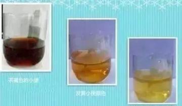 身体这个部位变黑，说明你“肝毒”已深！排肝毒养肝只需……  葛根粉丰胸有效果吗 养肝护肝食谱 白发变黑发小偏方 月经不调会导致不孕吗 白癜风部位 肝脏上有囊肿 爱拼就会赢 女人最性感的部位 银项链变黑 导致甲状腺肿大 第4张