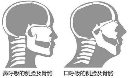 鼻塞、喷嚏不断，春季鼻炎太折磨人？每天来点它，不再为鼻炎困扰  妹妹是魔女的话是很困扰的 鼻炎鼻塞吃什么药 感冒鼻塞流鼻涕打喷嚏 管易通破解版 鼻腔过滤器 鼻腔囊肿手术 鼻腔黑色素瘤 如何缓解鼻炎鼻塞 感冒流鼻涕打喷嚏 北京治疗鼻炎的医院 第2张