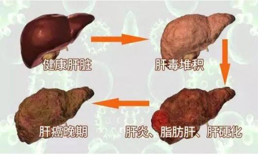男人“肝”净就强壮，女人“肝”净就漂亮！中医有妙招，帮你养肝  女人的小鸡真实图片 春季养肝食谱 精选食材 男人说离婚 一按我帮你 小三阳怎样护肝养肝 生活常识妙招 爱拼就会赢 帮你选手机 不花钱祛斑小妙招 第8张