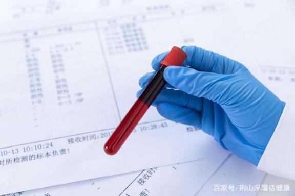 糖尿病患者口中飞出烂苹果味，预兆血糖控制不佳，出現5预兆，不可以忽略  日晕出现有什么预兆 孤独患者mv 孕妇都不可以吃什么 广州医院一男患者殴打女护士 可不可以不勇敢奈奈 产前预兆 七大罪圣战的预兆 糖尿病加号 空竹的基本情况 糖尿病的食疗方法 第1张
