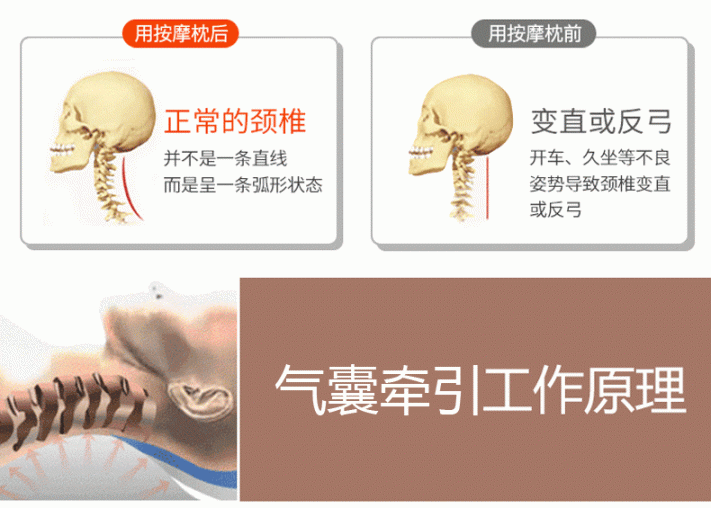 为何颈椎骨为“百病之源”？这种不适感暗示着你的脊柱出难题了  治疗颈椎病枕头 治疗颈椎病的项链 什么叫强直性脊柱炎 颈椎病的治疗方案 颈椎骨质增生的治疗 颈椎骨刺增生 颈椎骨质增生偏方 预防颈椎病的方法 爱的错位 强直性脊柱炎的检查 第6张