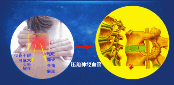 颈椎不好伤全身上下！用“它”连通淤阻，颈部更轻轻松松~  颈椎按摩器哪种好 怎么样可以缓解痛经 竹炭颈椎枕 健康之路颈椎病视频 颈椎病的日常保健 治疗颈椎病枕头 颈椎病按摩器 上海颈椎病医院排名 颈椎按摩器十大品牌 增强身体抵抗力 第5张