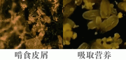 头皮瘙痒，冒油多，或许是满虫在乱爬，这一去螨土方式没谁了！  除螨吸尘器排名 男人就爱这一套 艾草面膜 图解丰田生产方式 活性炭雕价格 联系方式英文怎么说 面部螨虫怎么去 这一生只有你最好 考研成绩查询方式 艾草仙姑电影 第3张