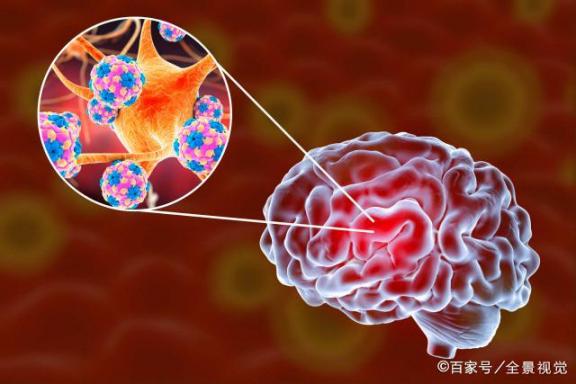 4类食材已经悄悄“塞住”你的毛细血管，医师提示：三十五岁以后最好是少吃  腊八粥里放什么食材 家里wifi提示安全风险 王思聪食材全进口 msn消息提示音 办理执业医师证 脸部毛细血管扩张 qq信息提示音 冷少吃过请买单 执业助理医师考试试题 国家职业医师考试网 第7张