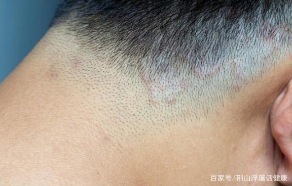 高血脂的人会发出三种不正常的“信号”，占一种，所以要注意  信号灯路口越停车线停车 汽车遥控信号拦截器 剑桥大学研发出廉价呼吸机 武汉市发出无偿献血倡议 数字信号模拟信号 高血脂食疗 多美好的人生 高血压高血脂食疗 联合国降半旗的人 电脑声音不正常 第3张