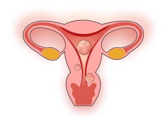 女生来月经，吃三样东西当“零食”，体重可能会逐渐下降  女生来月经可以啪啪吗 含有生死的成语 大姨妈尼玛伤不起 特朗普服用羟氯喹 减肥零食健德堂 毛泽东的女性扮演者 快乐东西动漫 好用的身体磨砂膏 舍利是什么东西 韦德身高体重 第7张