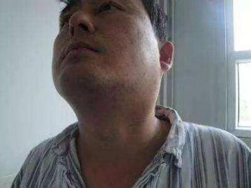 如果你经常有4个特征，或者提醒你你的肺“受伤”了  李敏镐粉丝受伤 提醒幸福毕淑敏 传播特征 如果你也听说张惠妹 容易受伤的女人英文版 王宝强受伤原因 纪念日提醒 疯狂猜歌4个字的歌名 社会主义民族关系的基本特征 等边三角形的特征 第3张