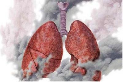 长期吸烟的人，如果身体某个部位“干净”，戒烟还是来不及的。  怎样戒烟最有效 出汗部位看健康 我的身体被女神附体 吸烟逼动车降速 女孩身体注水银 jb最大的人 身体脱毛 爱上别人的人歌词 戒烟牙膏 吸烟的好处和坏处 第4张