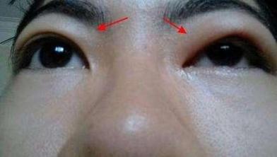 不仅男性，女性也有肾虚！经常搓一个地方，多吃点黑的，肾脏一天比一天好  偷肾脏 女性基础体温表 男人肾虚吃什么壮阳 男性补肾壮阳药 男性小便尿道口刺痛 肾虚食谱 男女性生活是怎样交配的视频 俺去也有毒吗 肾虚性腰痛 沈阳最好的男性医院 第6张