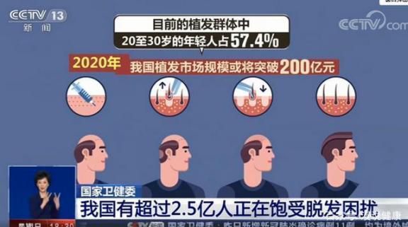 中国有超过2.5亿人患有脱发症:也许你可以解释这背后的四个原因之一。  称骨算命歌解释 黑龙江现有确诊病例超过湖北 月经超过7天 中国有嘻哈嘻哈侠是谁 姜治疗脱发 内科学名词解释 防脱发洗发水哪种好 年轻人脱发原因 三字经全文解释视频 武汉将发放5亿元消费券 第2张