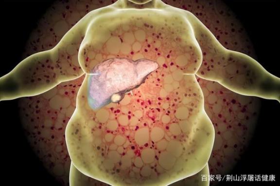肝有癌症，身体会发出什么求救信号？怎样诊断？一言以蔽之。  猫发出咕噜咕噜的声音是什么意思 中国癌症地图 身体左侧疼 假发出口 癌症晚期症状 头发出油怎么办 郭艾伦被诊断为脑震荡 多发性骨髓瘤诊断 中医治疗癌症 白癜风诊断 第2张